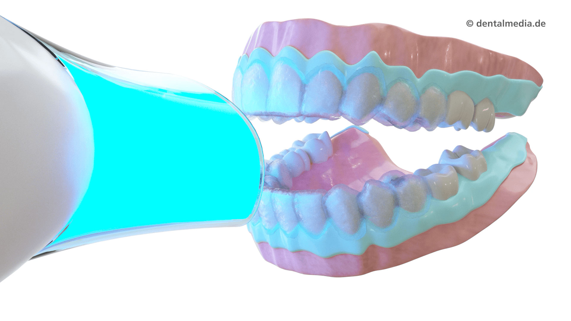 Ästhetik — Schöne und gesunde weiße Zähne