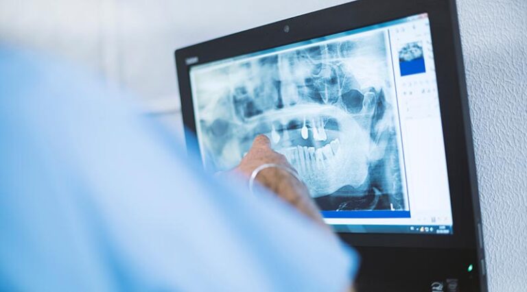 ki könnte bei der röntgendiagnostik helfen