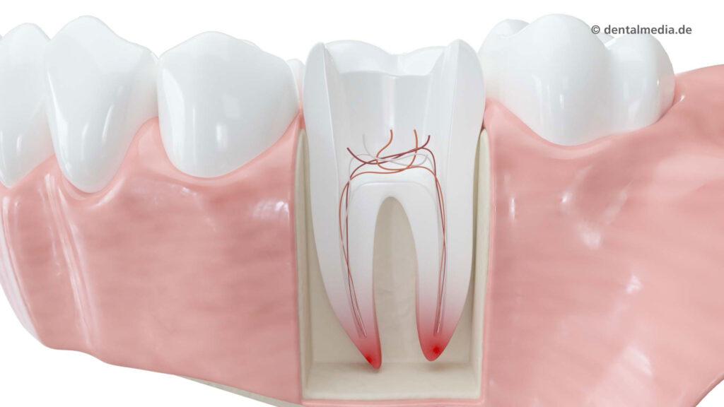 Endodontie — Erhalten Sie Ihre neuen Zähne